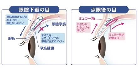 作用機序