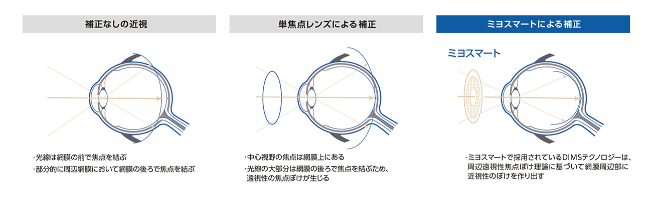 ミヨスマート